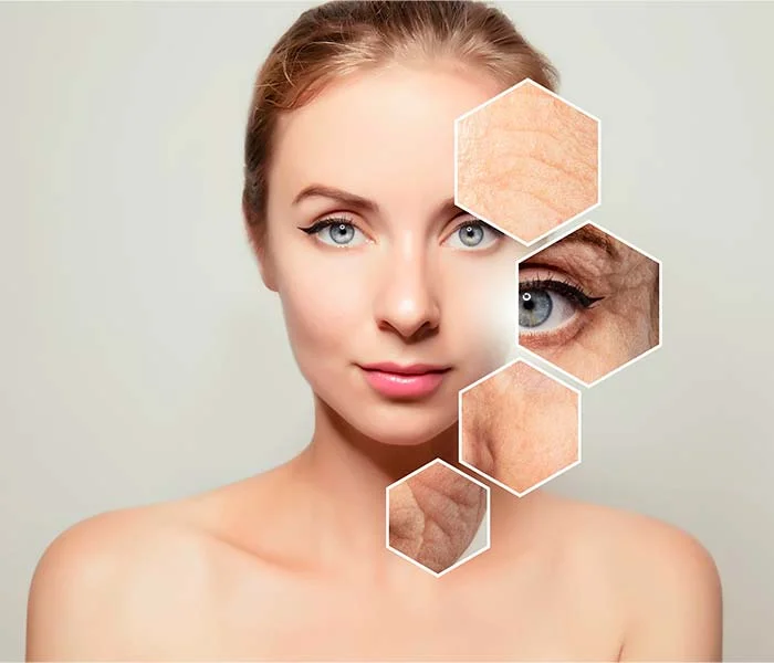 aplicação de ácido hialurônico