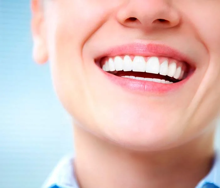 lente de contato dental