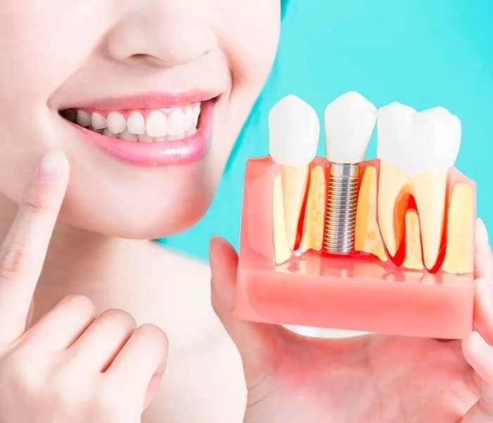 implante dentário